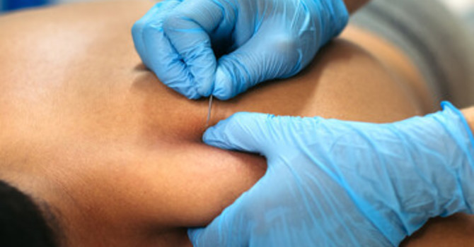Recovery Services