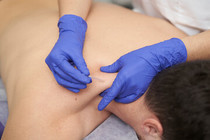 Dry Needling Sugar Land