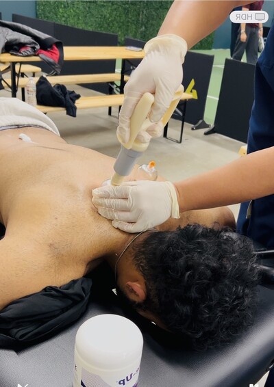 Cupping Sugar Land Physical Therapy